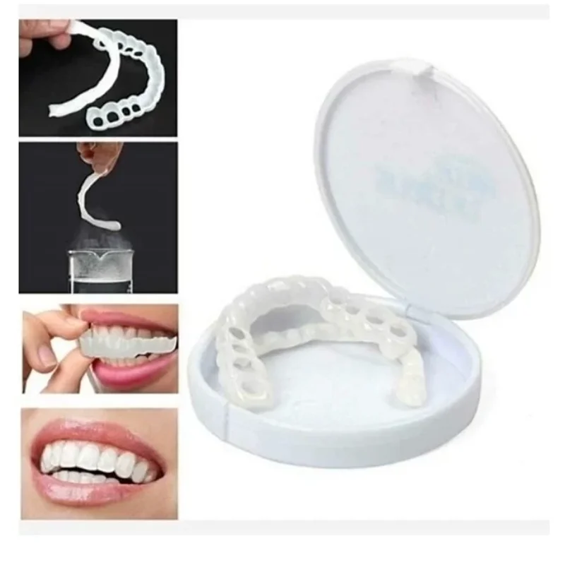 لمینت متحرک دندان ردیف بالا